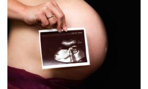 УЗИ во время беременности: необходимость и безопасность