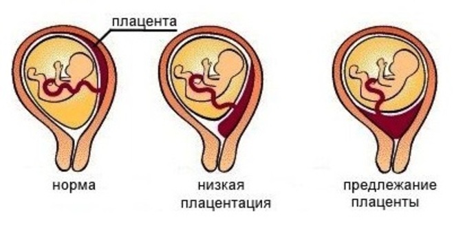 УЗИ в Усть-Каменогорске: переводим с медицинского